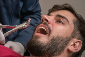 young man having a tooth pulled by a dentist 