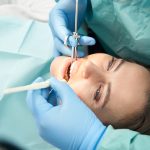 doctor in blue gloves performing a root canal