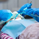doctors in blue gloves providing sedation during a dental procedure